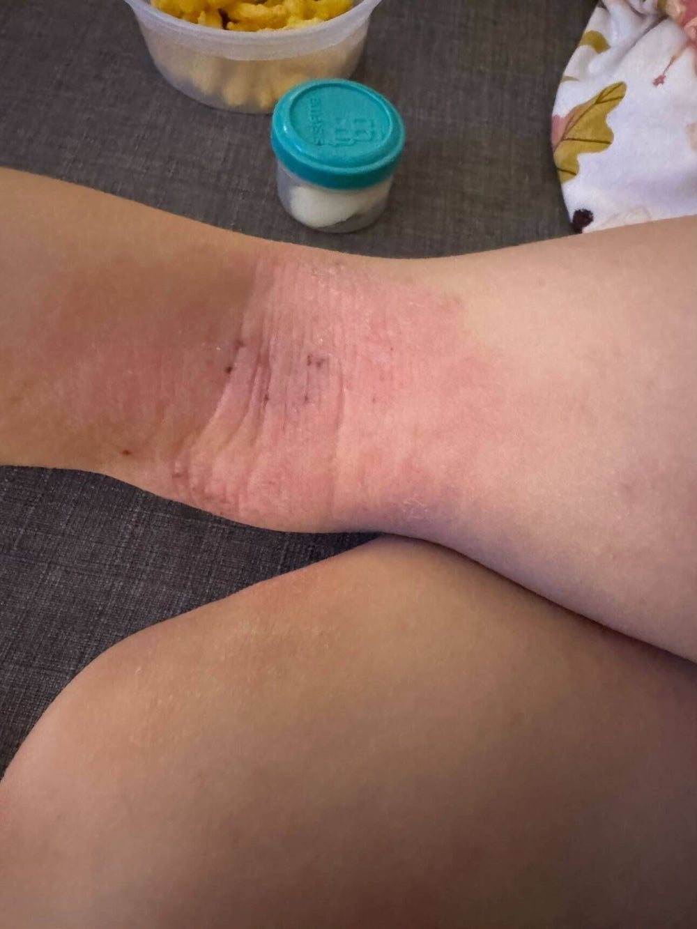 Before treatment result image