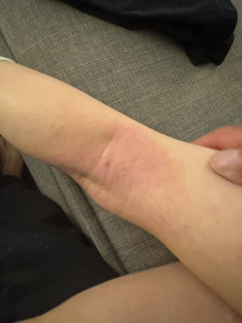 After treatment result image
